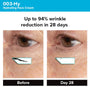 Photogrammetric image from clinical trial of 003-Hy Hydrating Face Cream showing a 94% wrinkle reduction in 28 days.