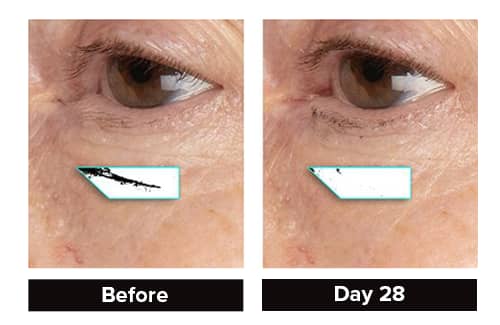 Photogrammetric clinical trial image showing 94% reduction in fine lines within 28 days