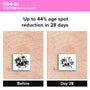 Photogrammetric image from clinical trial of 004-Br Skin Brightening Cream showing 44% age spot reduction in 28 days.