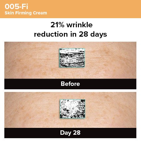 Photogrammetric image from clinical trial of 005-Fi Skin Firming Cream showing 21% wrinkle reduction ion 28 days