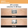 Photogrammetric image from clinical trial of 005-Fi Skin Firming Cream showing 21% wrinkle reduction ion 28 days