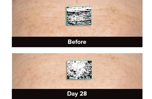 Photogrammetric image from clinical trial of 005-Fi Skin Firming Cream showing 28% reduction  in the appearance of wrinkles in 28 days