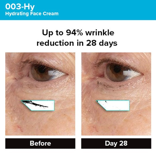 Photogrammetric image from clinical trial of 003-Hy Hydrating Face Cream showing 94% wrinkle reduction in 28 days