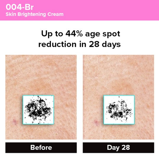 Photogrammetric image from clinical trial of 004-Br Skin Brightening Cream showing 44% age spot reduction in 28 days.